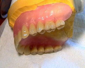 Oberkiefer Zahnprothese