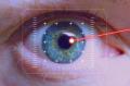 Ein Auge im fadenkreuz beim Lasern